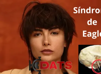 Maria Casadevall Revela Batalha contra Síndrome Rara e Cirurgia Inesperada