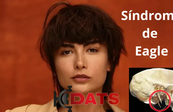 Maria Casadevall Revela Batalha contra Síndrome Rara e Cirurgia Inesperada