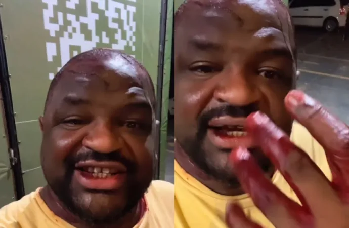 Humorista acusa ter sido agredido por seguranças em restaurante no Marista; estabelecimento se manifesta