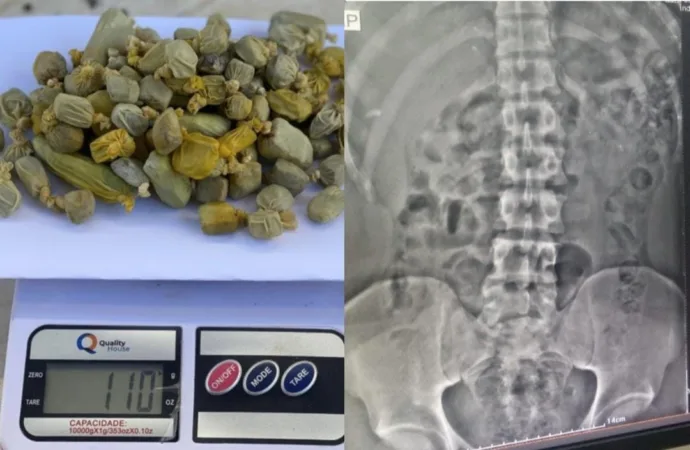 Mecânico é flagrado com drogas no estômago após ser preso de propósito em Goiás
